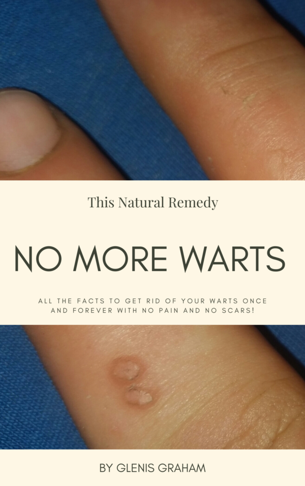 NO More Warts 1