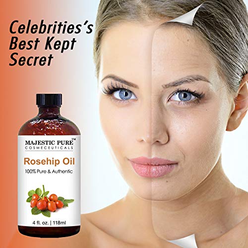 majestic pure rosehip oil for face nails hair and skin 100 pure natural cold pressed premium rose hip seed oil 4 oz 5e1b432aa2e40